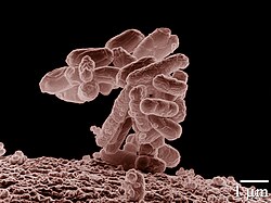 Žarninės lazdelės (Escherichia coli)